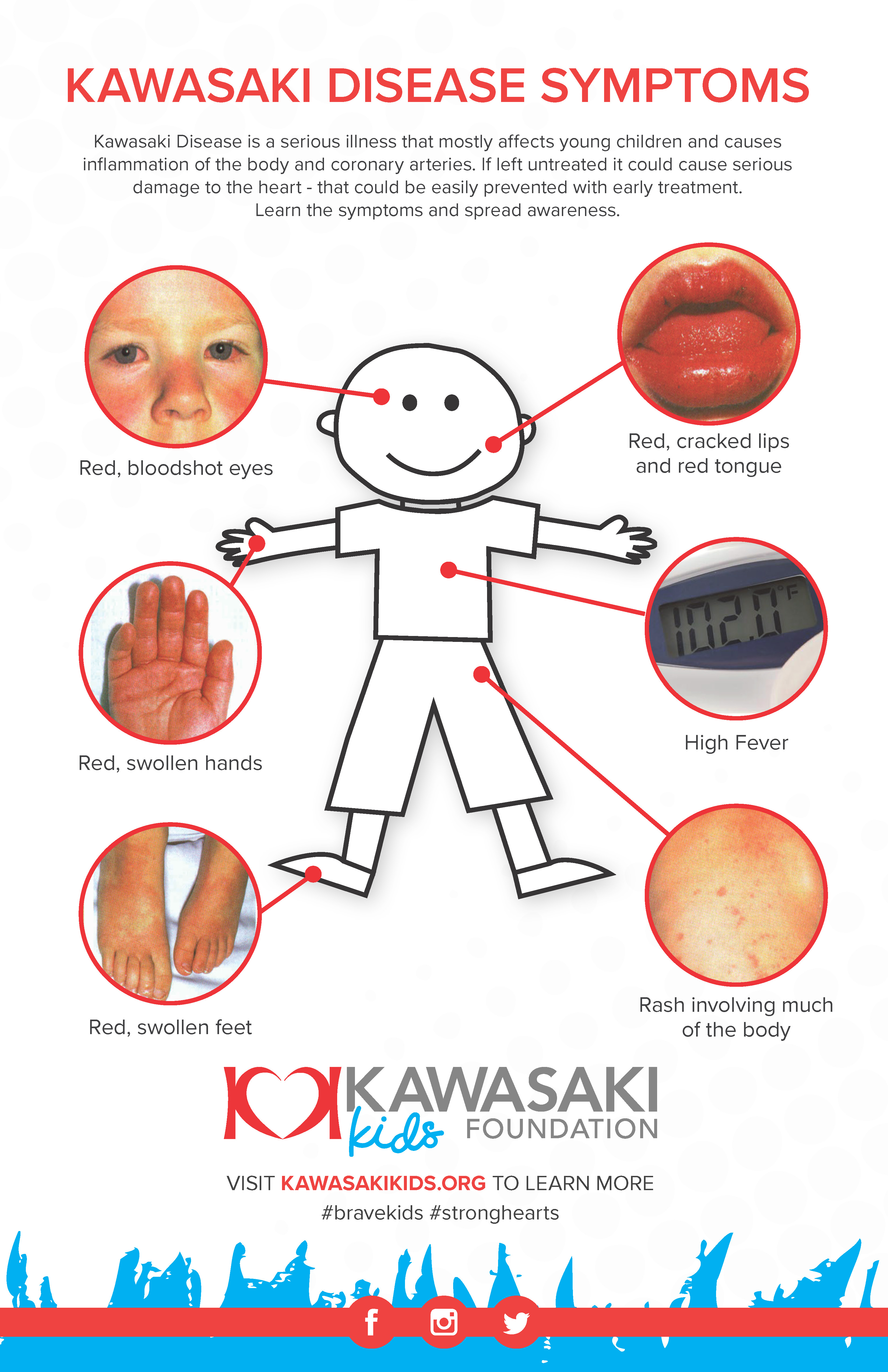 medical research internship for kawasaki disease